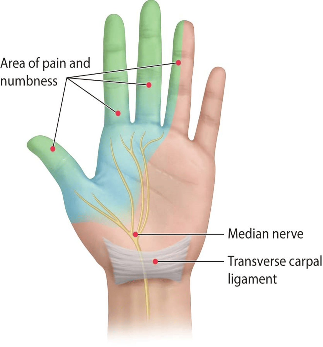 diagram of nerve pain from nclex question bank