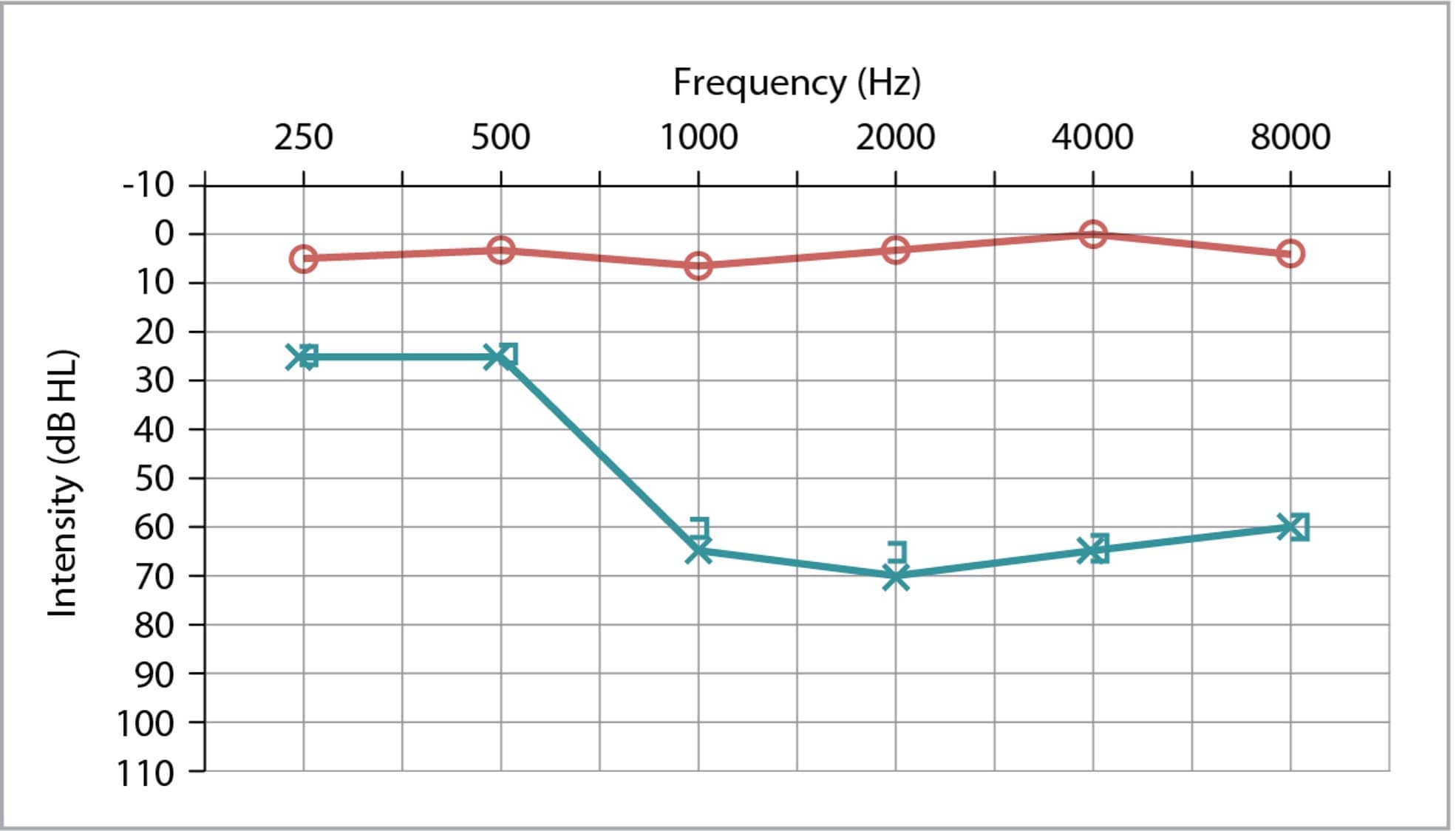 audiogram chart