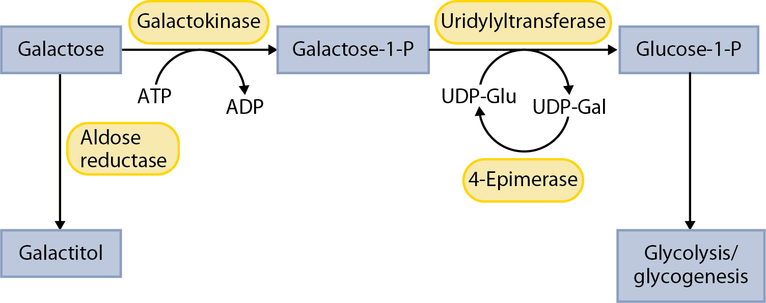 Diagram of galactose metabolism showing conversion of galactose to galactose-1-phosphate by galactokinase and to glucose-1-phosphate via uridyltransferase and epimerase, with galactitol formation via aldose reductase.