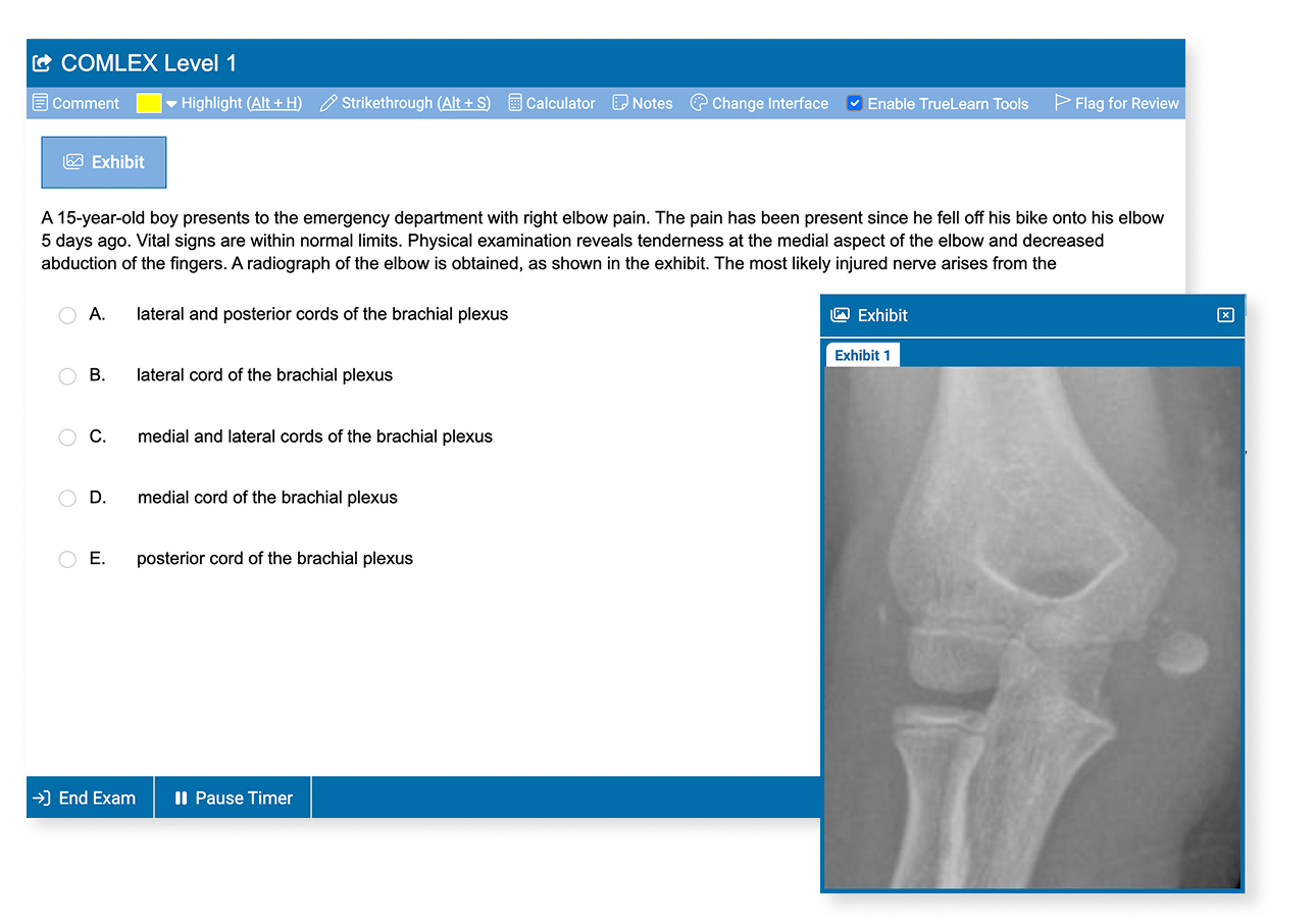 COMLEX Level 1 practice question showing a right elbow X-ray. The question pertains to a brachial plexus injury. Exhibit window magnifies the X-ray.