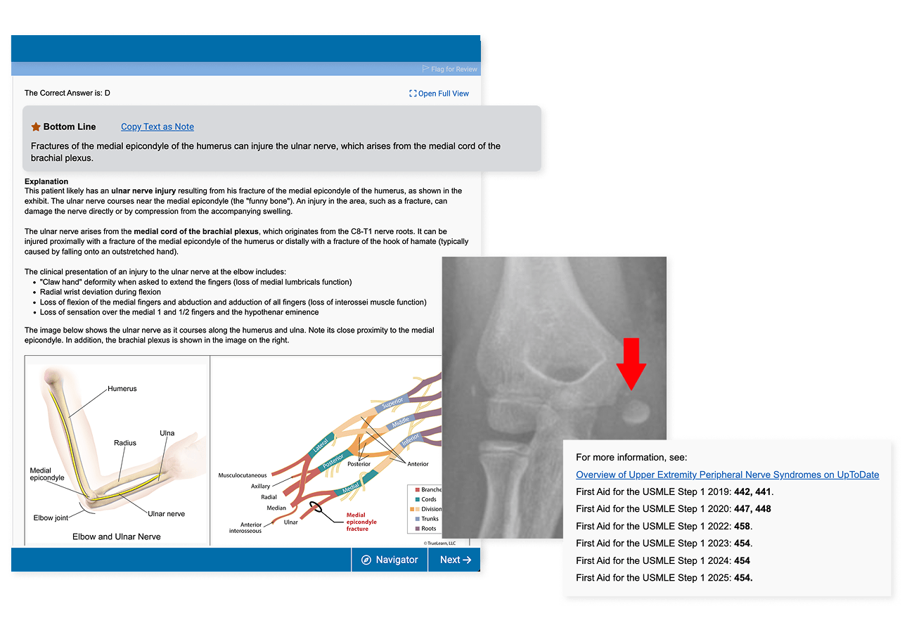 TrueLearn platform showing the COMLEX interface with a Level 1 practice question and medical illustrations