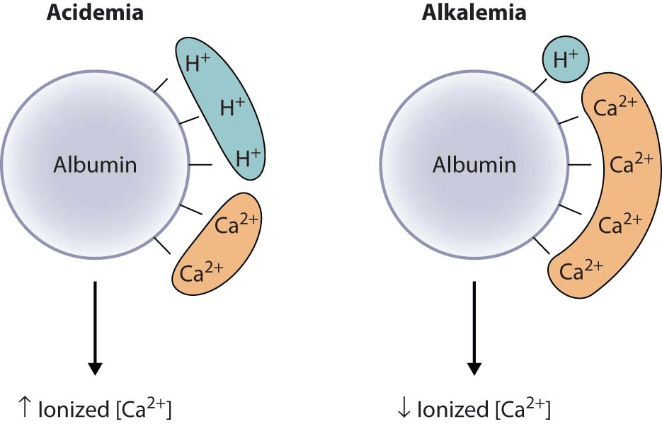 Diagram showing that acidemia increases ionized calcium, while alkalemia decreases ionized calcium due to changes in calcium binding to albumin.