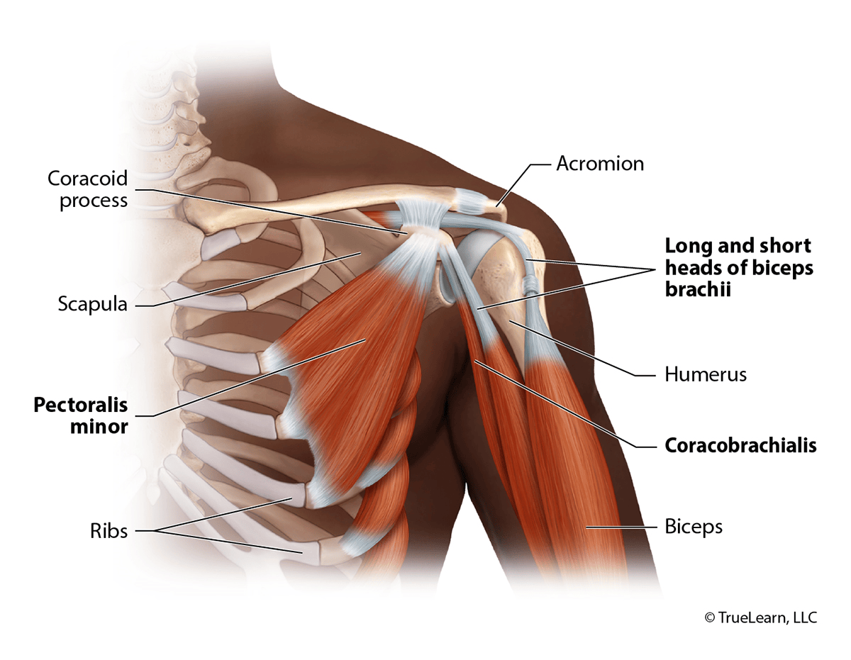 Diagram of shoulder anatomy labeling the coracoid process, acromion, scapula, humerus, pectoralis minor, coracobrachialis, and the long and short heads of the biceps brachii.