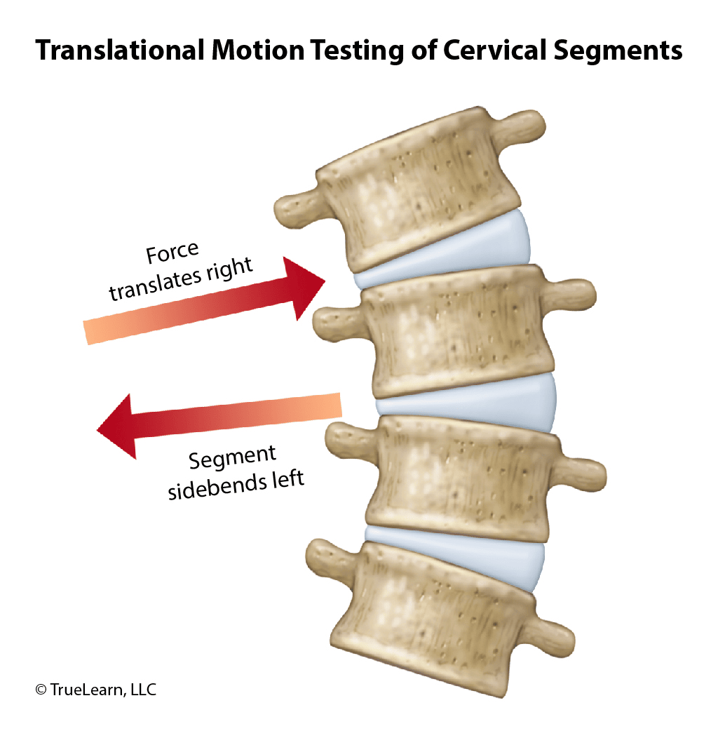 image of translational motion testing of cervical segments
